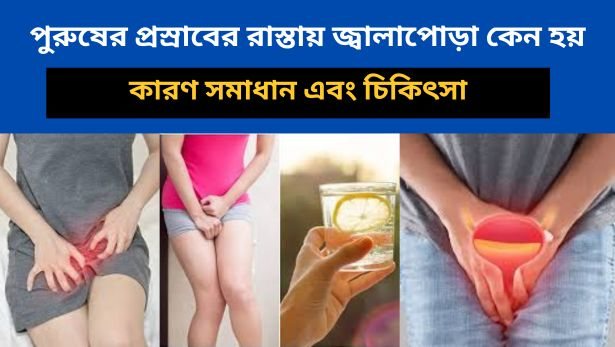 পুরুষের প্রস্রাবের রাস্তায় জ্বালাপোড়া কেন হয়