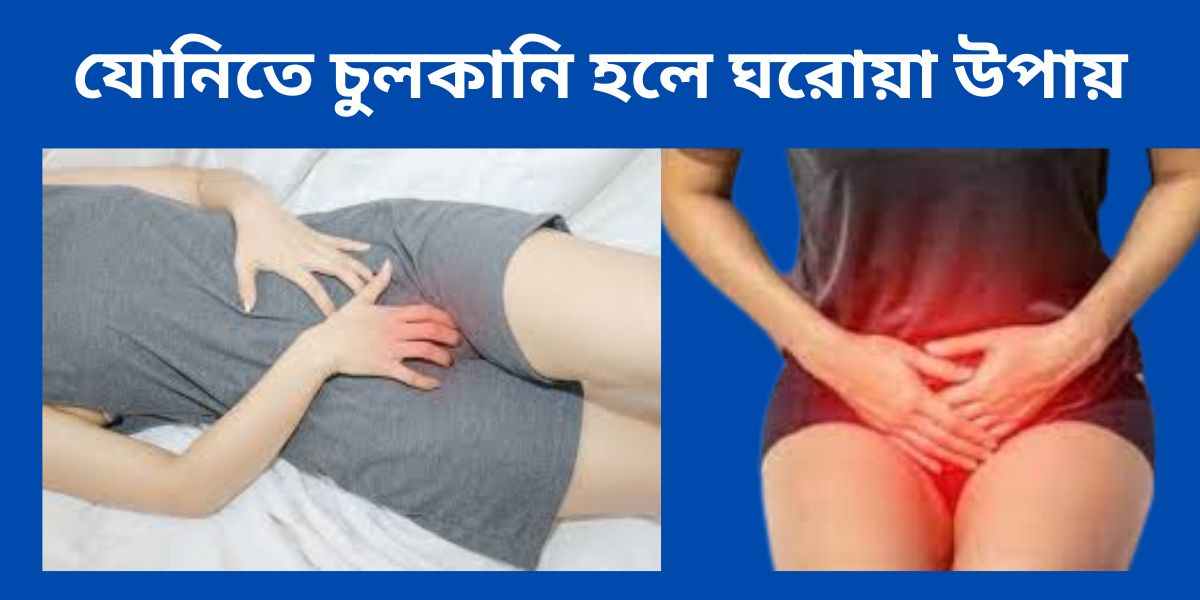 যোনিতে চুলকানি হলে ঘরোয়া উপায়